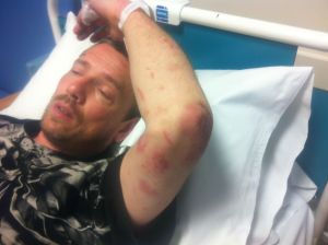 Photo of Paul Ponting in hospital.